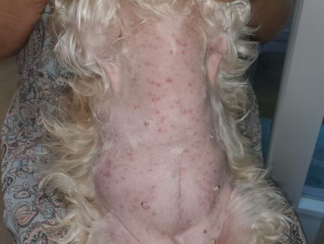 모낭염 치료 전 – 배와 가슴 피부에 붉은 구진이 퍼져 있는 모습